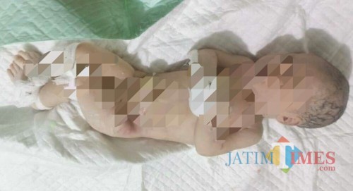 Bayi yang meninggal di WC Puskesmas Kauman / Foto : Istimewa / Tulungagung TIMES