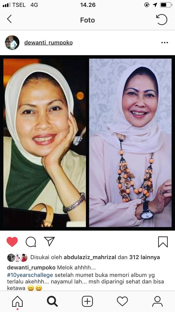 Sebelah kiri foto Wali Kota Batu Dewanti Rumpoko tahun 2009 dan masa kini. (Foto: ig @dewanti_rumpoko)