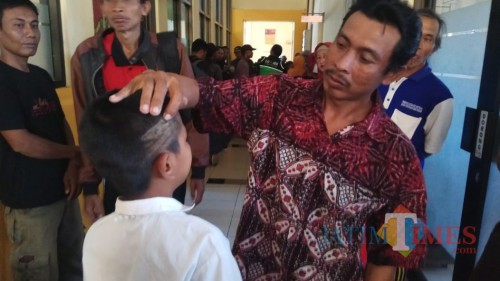 Orang tua NS menunjukan kepala anaknya yang terluka akibat rambutnya dipotong dengan tidak beraturan