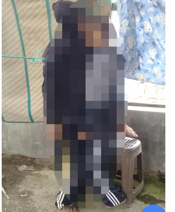 Kondisi mengenaskan pasangan suami istri Supriadi dan Trisapta Ning Diyah Yuliasih, korban bunuh diri, sesaat sebelum dievakuasi petugas di Tumpang. (Foto : Istimewa)