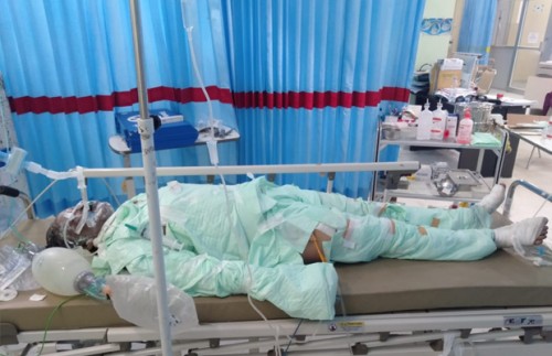 Korban Lasmini saat menjalani perawatan di Rumah Sakit. (Foto: istimewa)