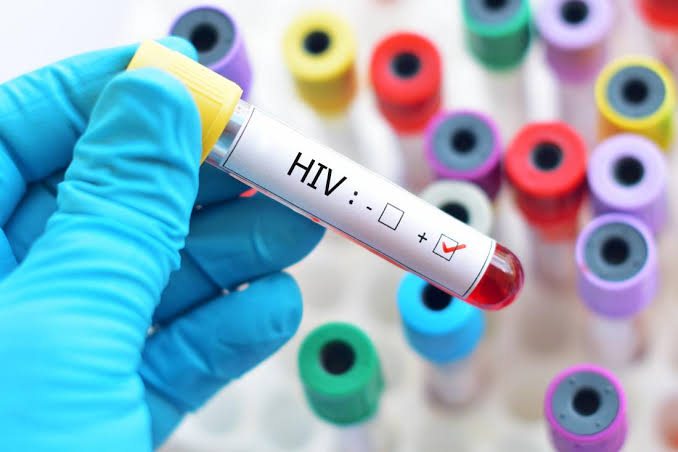 Ilustrasi HIV