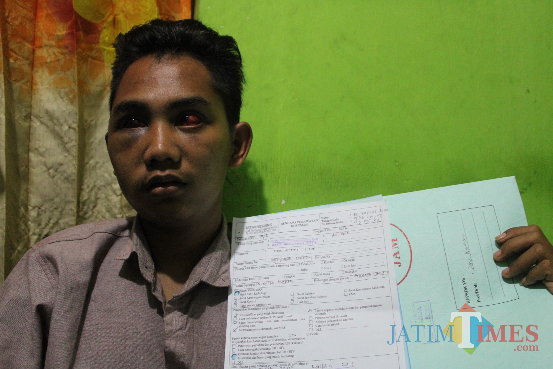 Huda, salah satu korban penganiayaan yang diduga dilakukan oleh oknum polisi di Jombang. (Foto : Adi Rosul/ JombangTIMES)
