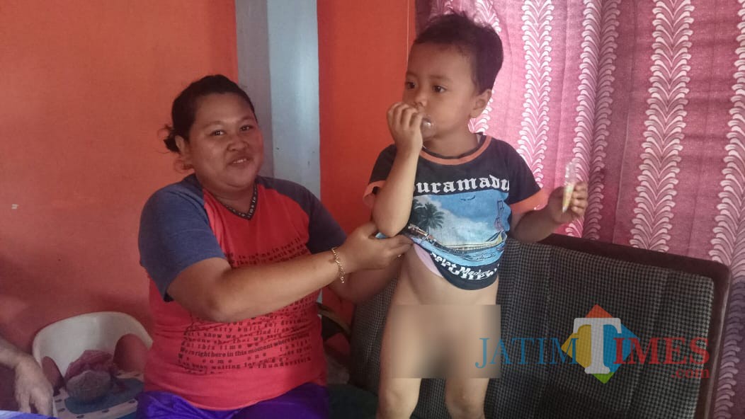 Rehan, bocah yang diduga dikhitan jin bersama Ibunya Riski Amalia