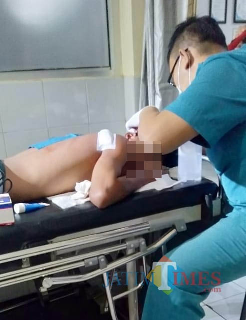 Kondisi korban pembacokan saat menjalani perawatan intensif di rumah sakit (Foto : Polsek Tumpang for MalangTIMES)