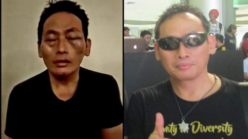 Ninoy relawan Jokowi akhirnya melaporkan penculikan dan penganiayaan ke kepolisian yang bergerak cepat menciduk pelaku (Ist)