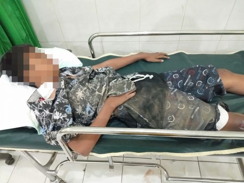 Kondisi Aril Ardiansyah usai mengalami kecelakaan usai kendaraannya terjerat benang layangan. (Foto : Polsek Gondanglegi for MalangTIMES)