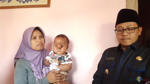 Wali Kota Malang Sutiaji (kanan) saat menyambangi bayi pengidap meningokel (Pipit Anggraeni/MalangTIMES).
