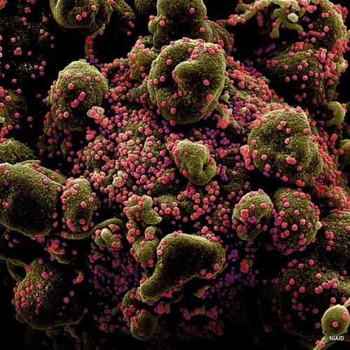 Bintik-bintik Virus Corona yang menempel pada sel mati tubuh manusia (Scan mikroskop elektron yg telah diwarnai by NIAID)