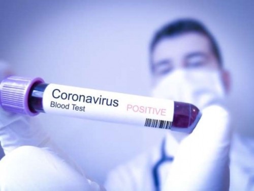 Ilustrasi hasil rapid test. (Foto: Istimewa)