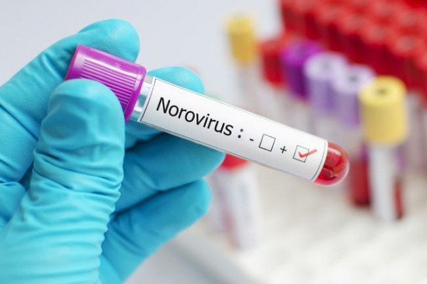 Norovirus (Foto: The Schmidt Firm)