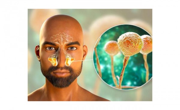 Ilustrasi Cara Menghilangkan Jamur Hitam di Nat Keramik Kamar Mandi - Solusi Jitu: Cara Menghilangkan Jamur Hi