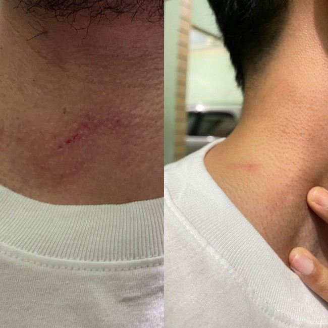 Tampak bekas cakaran diduga oknum jukir di Sawojajar. (Foto: X)